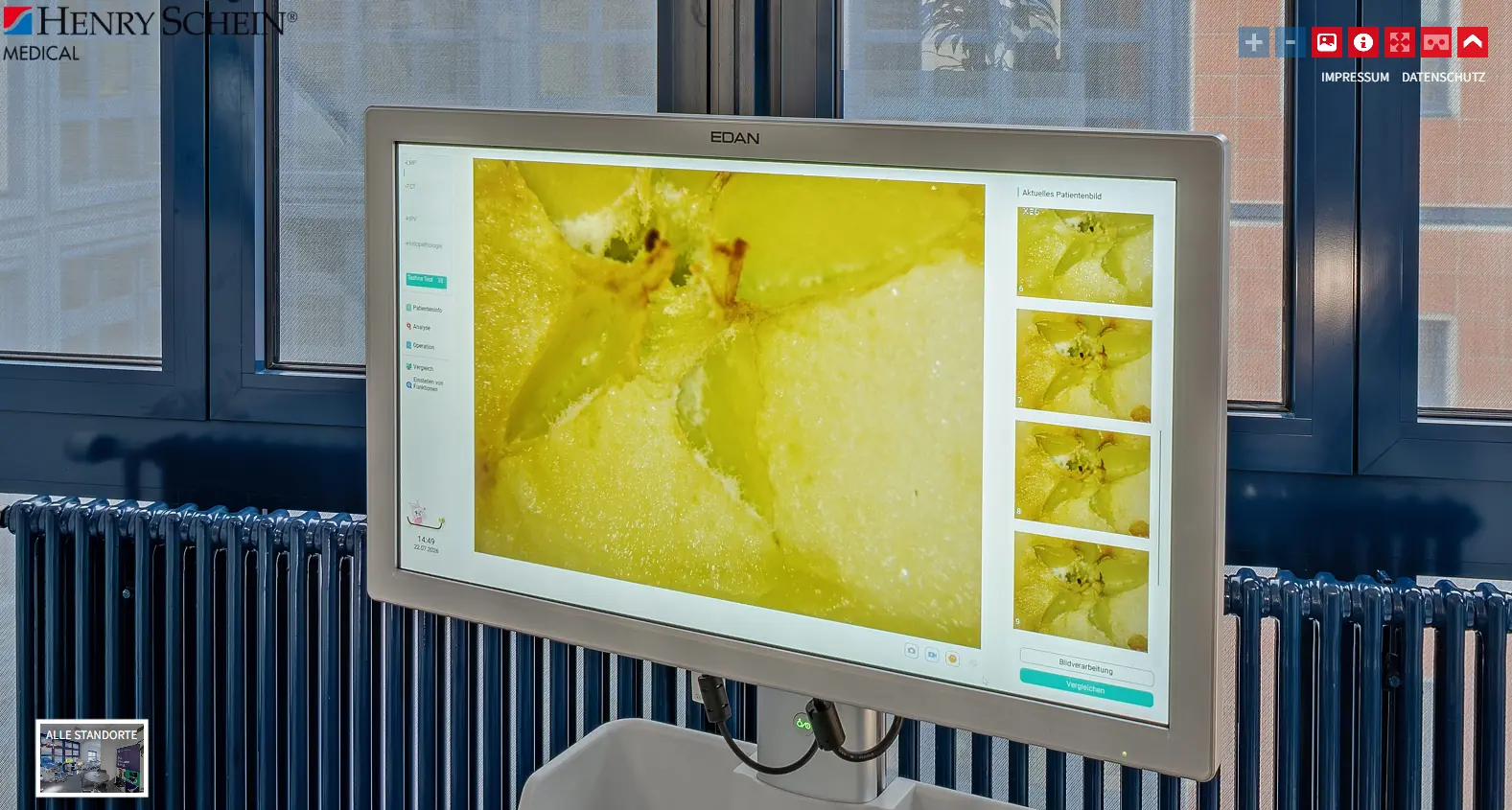 Detailaufnahme des Displays eines medizinischen Bildgebungssystems als Nachweis der Panorama-Bildqualität