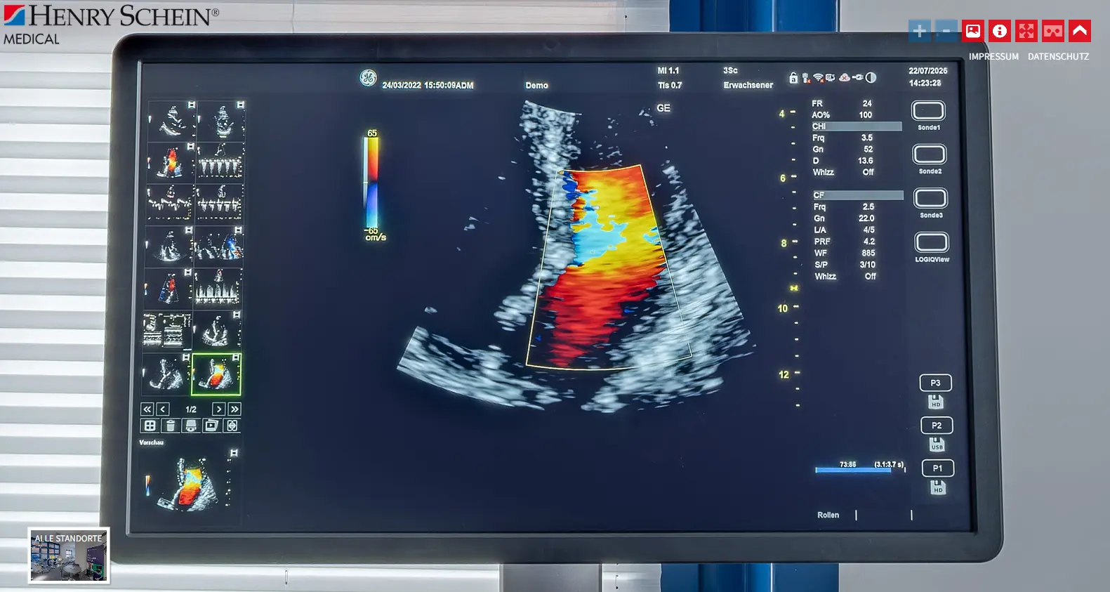 Detailaufnahme eines Ultraschallbildes auf einem GE-HealthCare-System