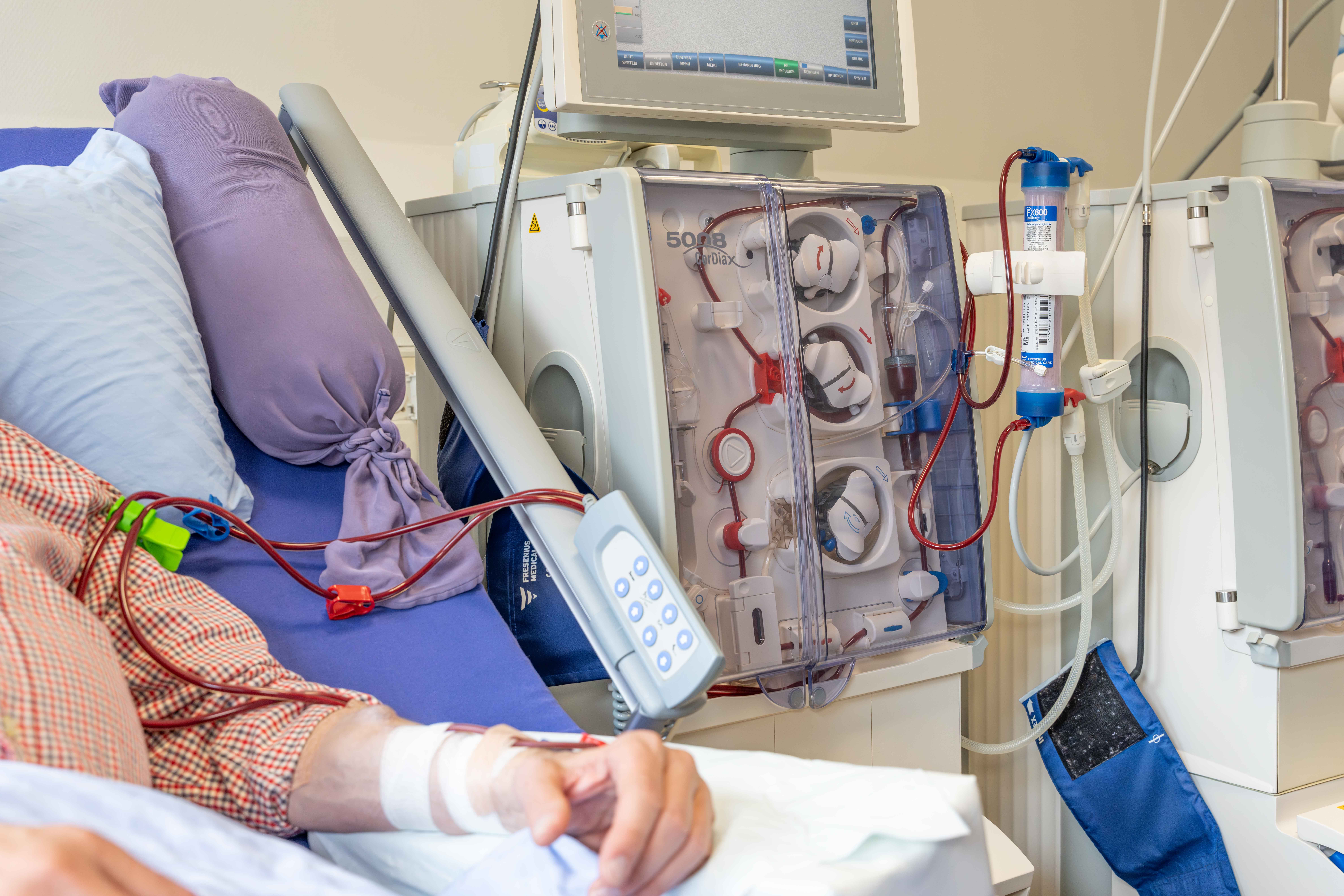 Dialysegerät Bedienung – Nephrologisches Zentrum Kiel
